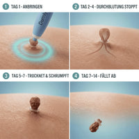 Krushop™ Dermly Advanced Skin Tag Care Set